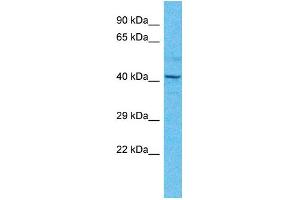 Host:  Rabbit  Target Name:  TEAD4  Sample Type:  Thyroid Tumor lysates  Antibody Dilution:  1. (TEAD4 antibody  (N-Term))