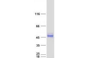 Validation with Western Blot (NUDT9 Protein (Transcript Variant 3) (Myc-DYKDDDDK Tag))