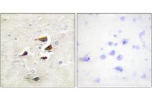 Immunohistochemistry analysis of paraffin-embedded human brain tissue, using CaMK2 alpha/beta/delta (Ab-305) Antibody. (CaMK2 alpha/beta/delta antibody  (AA 271-320))