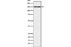 Western blot analysis of CLSTN1 expression in 293T cell lysate. (Recombinant Calsyntenin 1 antibody)