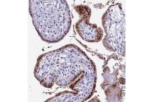 Immunohistochemical staining of human placenta with CC2D2A polyclonal antibody  shows strong nuclear and cytoplasmic positivity in trophoblastic cells. (CC2D2A antibody)