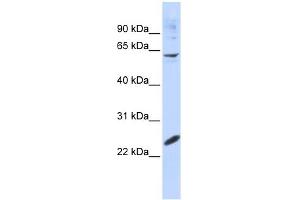 WB Suggested Anti-SMAD4 Antibody Titration:  0.