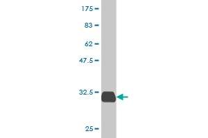 SPINK1 antibody  (AA 24-79)