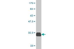 Western Blot detection against Immunogen (31. (SPINK1 antibody  (AA 24-79))