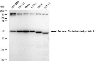 Western blotting analysis using Secreted frizzled related protein 4 antibody (ABIN7800286).