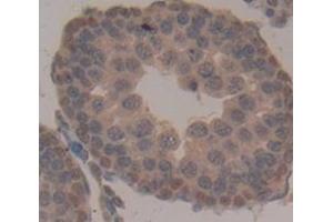 Used in DAB staining on fromalin fixed paraffin- embedded Kidney tissue (TPSB2 antibody  (AA 30-274))