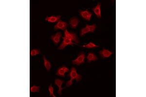ABIN6275981 staining Hela by IF/ICC. (CSRL1 antibody)