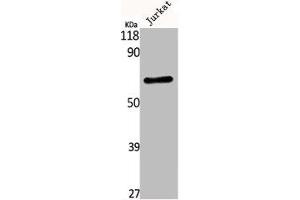 Western Blot analysis of Jurkat cells using Kv3. (Kv3.4 antibody)