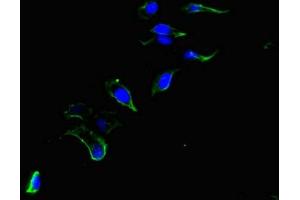 Immunofluorescent analysis of Hela cells using ABIN7147399 at dilution of 1:100 and Alexa Fluor 488-congugated AffiniPure Goat Anti-Rabbit IgG(H+L) (CEP192 antibody  (AA 447-711))