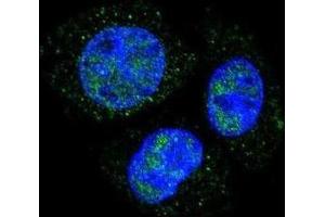 Immunofluorescence (IF) image for anti-Retinoblastoma 1 (RB1) (pSer811) antibody (ABIN3001786) (Retinoblastoma 1 antibody  (pSer811))