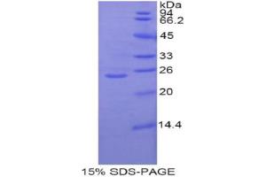 SDS-PAGE analysis of Rat GCLC Protein. (GCLC Protein)