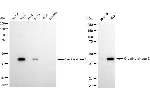 Western blotting analysis using creatine kinase B antibody (ABIN7798161).