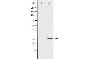 Western blot analysis of eIF4E expression in FBS treated NIH-3T3 whole cell lysates,The lane on the left is treated with the antigen-specific peptide.