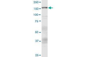 ASXL1 monoclonal antibody (M05), clone 6E2. (ASXL1 antibody  (AA 1-84))