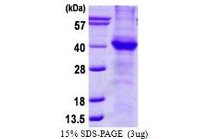 Image no. 1 for Amyloid beta (A4) Precursor Protein (APP) protein (His tag) (ABIN1098609)