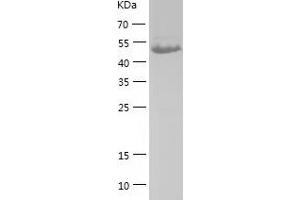 Western Blotting (WB) image for Pyruvate Dehydrogenase Complex, Component X (PDHX) (AA 54-501) protein (His tag) (ABIN7284244) (PDHX Protein (AA 54-501) (His tag))