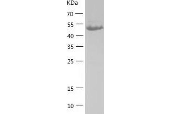 PDHX Protein (AA 54-501) (His tag)