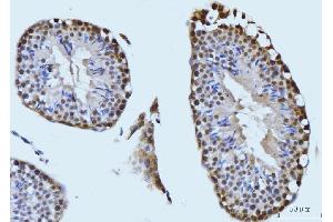 IHC analysis of SBNO1 using anti-SBNO1 antibody (ABIN7601710).