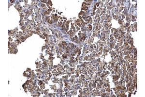 IHC-P Image AICDA antibody [N1N2], N-term detects AICDA protein at cytosol on mouse lymph node by immunohistochemical analysis. (AICDA antibody  (N-Term))