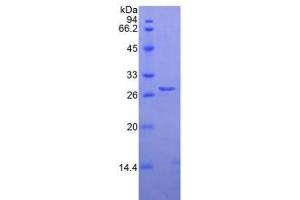 SDS-PAGE analysis of Human Elastase 3B Protein.