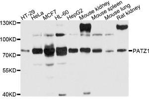 Western blot analysis of extracts of various cells, using PATZ1 antibody.