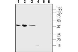 Western blot analysis of mouse muscle myoblast (C2C12), human brain glioblastoma ( MG), human colorectal adenocarcinoma  cell lines:1-3. (Uncoupling Protein 2 (Mitochondrial, Proton Carrier) (UCP2) Peptide)