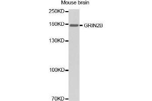 Western Blotting (WB) image for anti-Glutamate Receptor, Ionotropic, N-Methyl D-Aspartate 2B (GRIN2B) (C-Term) antibody (ABIN1680110) (GRIN2B antibody  (C-Term))