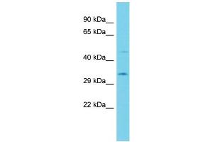 Host: Rabbit  Target Name: Acbd6  Sample Tissue: Rat Stomach lysates  Antibody Dilution: 1.
