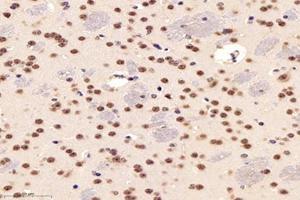 Immunohistochemistry analysis of paraffin-embedded mouse striatum using,PARC (ABIN7073606) at dilution of 1: 1200 (CUL9 antibody)