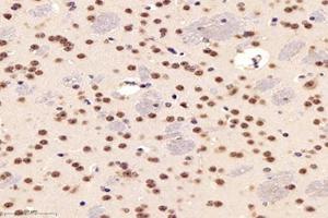 Immunohistochemistry analysis of paraffin-embedded mouse striatum using,PARC (ABIN7073606) at dilution of 1: 1200 (CUL9 antibody)