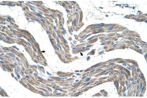 Human Muscle (GPR161 antibody  (C-Term))