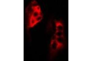 Immunofluorescent analysis of SCYL1 staining in MCF7 cells. (SCYL1 antibody)