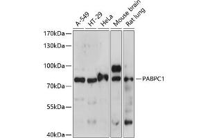 Western blot analysis of extracts of various cell lines, using P antibody (ABIN7269446) at 1:1000 dilution.