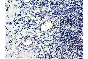 Image no. 5 for anti-Centromere Protein H (CENPH) antibody (ABIN1497471) (CENPH antibody)