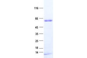 Validation with Western Blot (PNMA3 Protein (His tag))