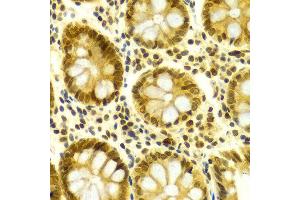 Immunohistochemistry (IHC) image for anti-ELAV (Embryonic Lethal, Abnormal Vision, Drosophila)-Like 1 (Hu Antigen R) (ELAVL1) (AA 1-326) antibody (ABIN3022231)
