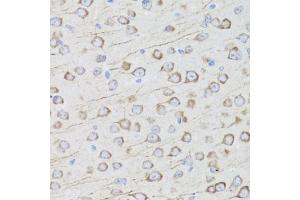 Immunohistochemistry of paraffin-embedded mouse brain using MIP antibody (ABIN3016917, ABIN3016918, ABIN3016919 and ABIN6219879) at dilution of 1:100 (40x lens). (Mip (AA 50-150) antibody)