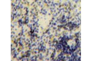 Used in DAB staining on fromalin fixed paraffin-embedded Spleen tissue (B-Cell Linker antibody  (AA 65-314))