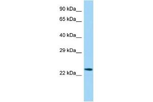 Host:  Rabbit  Target Name:  Etv3l  Sample Type:  Rat Spleen lysates  Antibody Dilution:  1. (ETV3L antibody  (Middle Region))