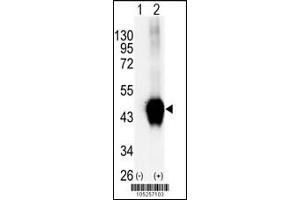 Western blot analysis of BCKDK using rabbit polyclonal. (BCKDK antibody  (C-Term))