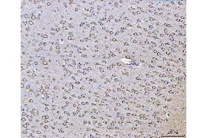 IHC analysis of PLD3 using anti-PLD3 antibody (ABIN7599439). (PLD3 antibody  (AA 1-490))