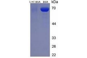 SDS-PAGE of Protein Standard from the Kit (BSA-5-HT). (Serotonin ELISA Kit)
