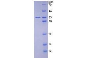 SDS-PAGE of Protein Standard from the Kit (Highly purified E. (C1QBP ELISA Kit)