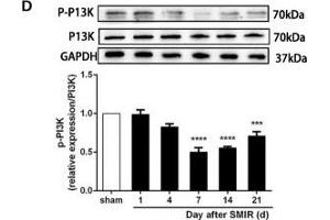 The CXCR7 and PI3K/Akt signaling pathways are involved in CPSP in the dorsal horn of the spinal cord. (GAPDH antibody)
