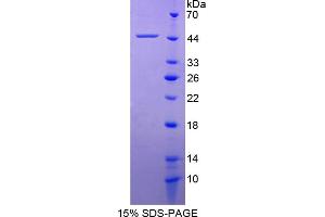 Image no. 1 for Platelet Derived Growth Factor D (PDGFD) (AA 19-370) protein (His tag) (ABIN4989627)