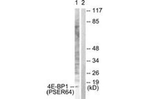 Western blot analysis of extracts from Jurkat cells treated with Insulin 0. (eIF4EBP1 antibody  (pSer64))
