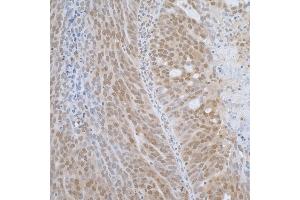 Immunohistochemistry (IHC) image for anti-Transcription Elongation Factor B (SIII), Polypeptide 1 (15kDa, Elongin C) (TCEB1) (AA 1-50) antibody (ABIN7453544)