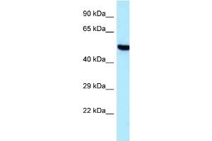 Western Blotting (WB) image for anti-threonyl-tRNA Synthetase 2, Mitochondrial (TARS2) (C-Term) antibody (ABIN2789298) (TARS2 antibody  (C-Term))