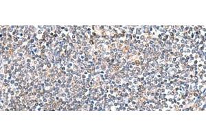 Immunohistochemistry of paraffin-embedded Human tonsil tissue using ITGA3 Polyclonal Antibody at dilution of 1:45(x200) (ITGA3 antibody)