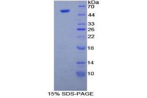 SDS-PAGE (SDS) image for Tubulin, beta 3 (TUBB3) (AA 222-438) protein (His tag,GST tag) (ABIN1981167)